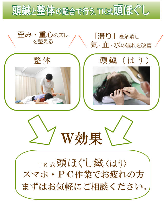 ＴＫ式頭ほぐし鍼は、